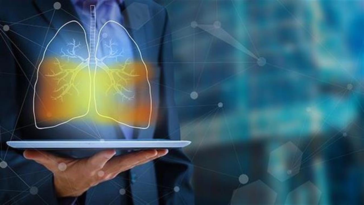 Πρόγραμμα τεχνητής νοημοσύνης βρίσκει τον καρκίνο του πνεύμονα