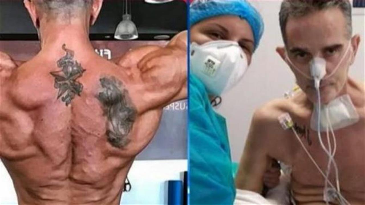 Βασίλης Μοϊντίνης: Έμεινε διασωληνωμένος 2 μήνες και έχασε 42 κιλά