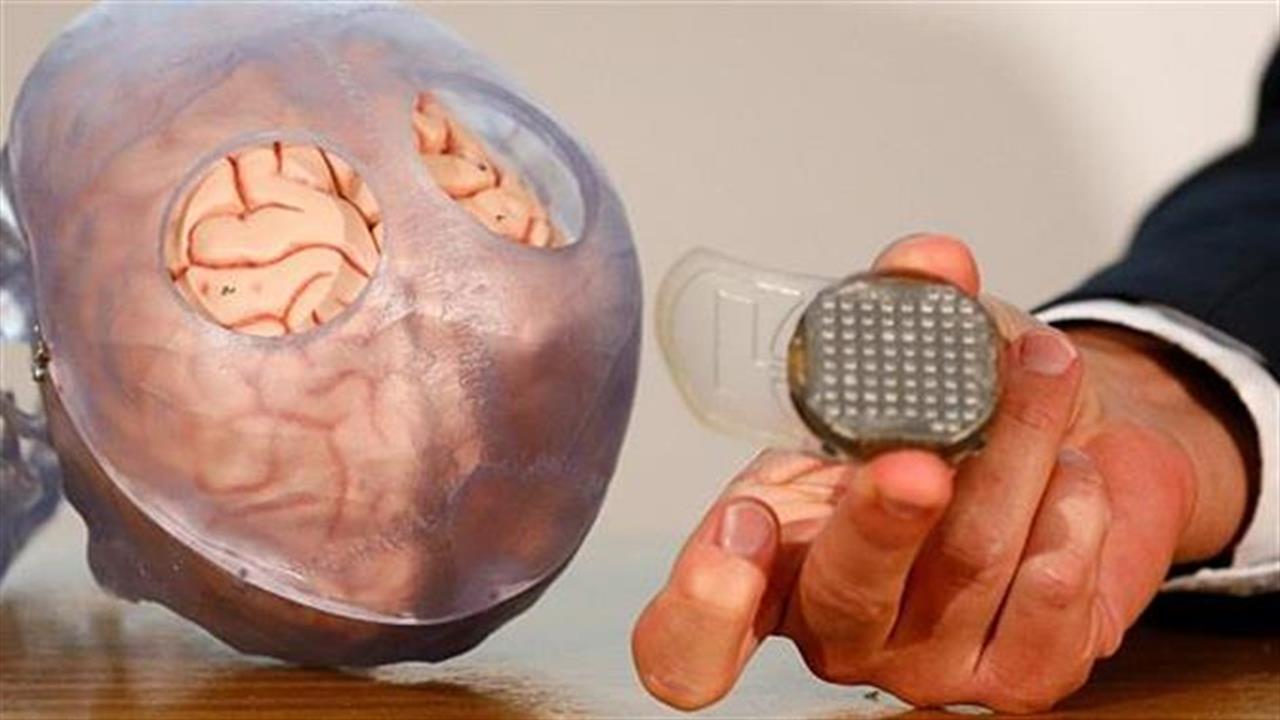 Συσκευή εμφυτευμένη στον εγκέφαλο επέτρεψε την επικοινωνία με παράλυτο ασθενή