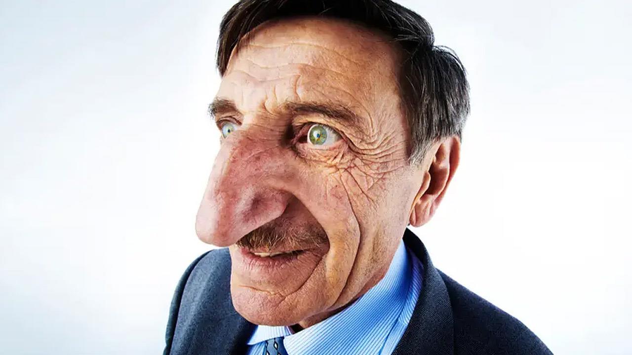 Πέθανε ο άνθρωπος με την μεγαλύτερη μύτη στον κόσμο