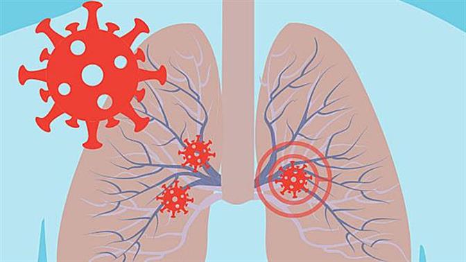 Τι συμβαίνει στους πνεύμονες σου αν κολλήσεις κορωνοϊό