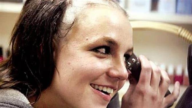 Να ξυρίσω το κεφάλι μου;