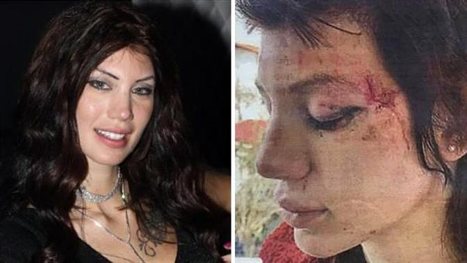 Γνωστή ηθοποιός ερωτικών ταινιών καταγγέλλει απαγωγή και ξυλοδαρμό από έξι γυναίκες