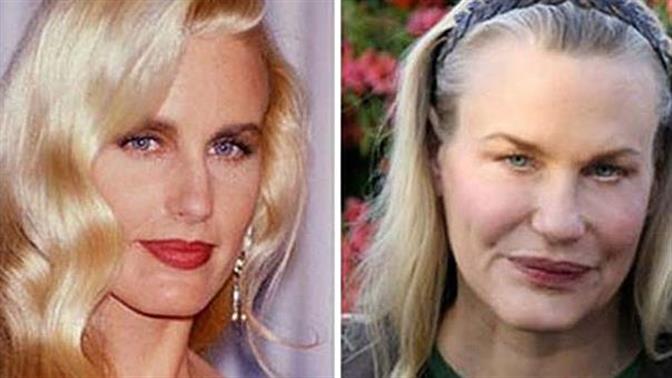 Οι πλαστικές των επωνύμων που δεν πήγαν και τόσο καλά