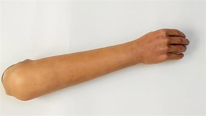 Πήγε να κάνει το εμβόλιο με ψεύτικο χέρι από σιλικόνη!