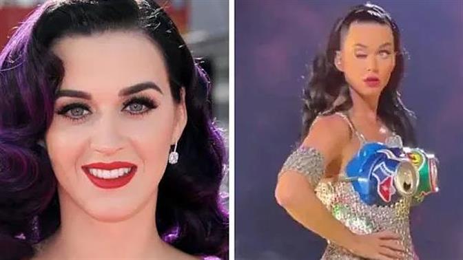 Γιατί παρέλυσε το μάτι της Katy Perry στη σκηνή; (video)