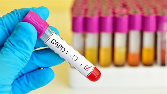 Έλλειψη ενζύμου G6PD: Τροφές που απαγορεύονται