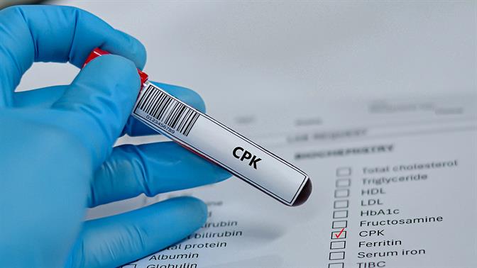 CPK: Τι είναι; Τι μετράει και γιατί είναι σημαντικό