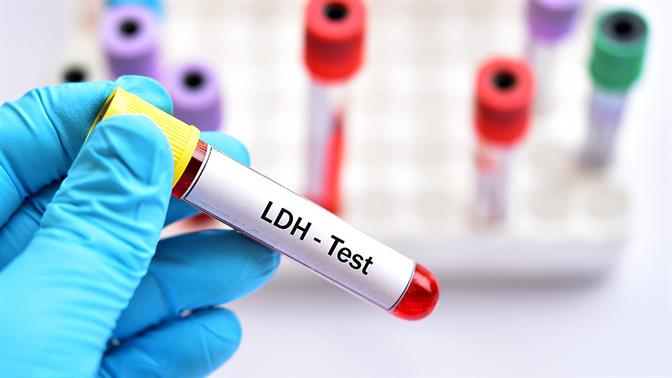 LDH: Τι είναι; Τι δείχνει και πώς ερμηνεύεται