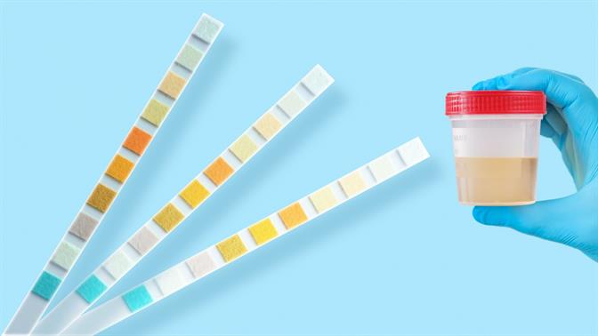 Τι λέει το χρώμα των ούρων σου για την υγεία;